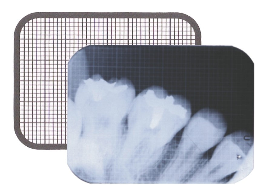 Dental X-Ray Grid IOPA