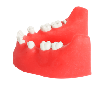 Impacted Tooth Extraction Surgery Dental Jaw Model