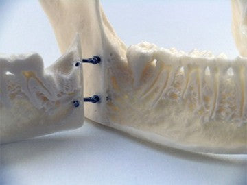 Dental Anatomical Mandible with Extractable Teeth