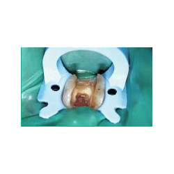 Insti Clamp