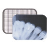Dental Xray Measuring Grid