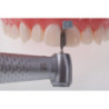 Directa FenderWedge Prep Dental Wedge & Per piece