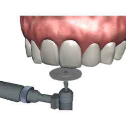 The Tooth- Patient Consultation / Education software - Digital