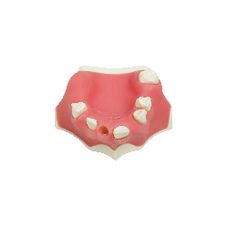 Model for immediate implant placement