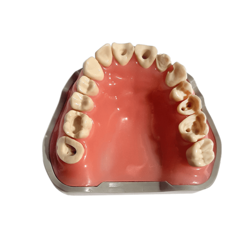 Prosthetic Dental Model with Prepared Teeth for Buildups and Post-and-Core Restorations (Upper) & UPPER JAW