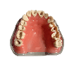 Prosthetic Dental Model with Prepared Teeth for Buildups and Post-and-Core Restorations (Upper) & UPPER JAW