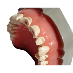 Prosthetic Dental Model with Prepared Teeth for Buildups and Post-and-Core Restorations (Upper) & UPPER JAW