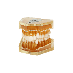 Dental model for teeth extraction