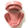 Edentulous Model for Prosthetic Training