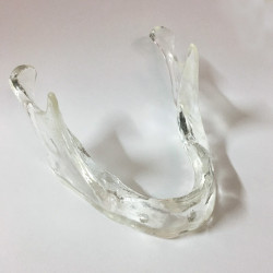 Transparent Implant Mandible