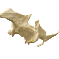Full-Scale Anatomical Jaw Model with Sinus – Zygomatic Implant Training