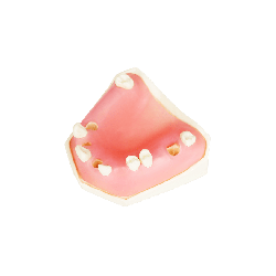 Post Extraction Immediate Implant Model