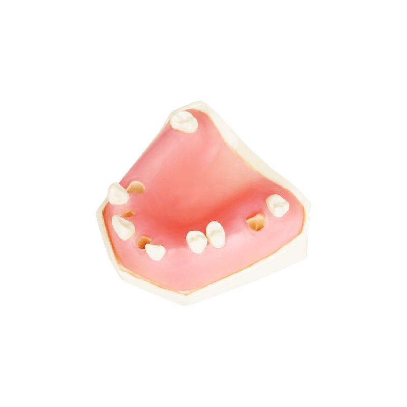 Post Extraction Immediate Implant Model