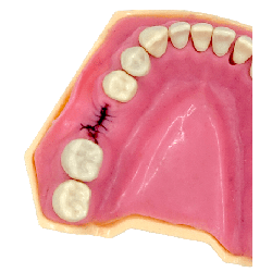 Navadha ZX Typodont Jaw