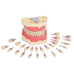 Navadha Endo Typodont Jaw Set & Endodontics Practice Model Extra Teeth Set
