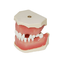 Dental Typodont Jaw / Model for Surgery Practice & Model for Surgery