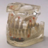 Dental Typodont Jaw / Model for Surgery Practice & Transparent Guide Model