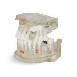 Dental Typodont Jaw / Model for Surgery Practice & Model for Surgery