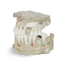 Dental Typodont Jaw / Model for Surgery Practice & Model for Surgery