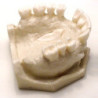 Dental Typodont Jaw / Model for Surgery Practice & Model for Surgery