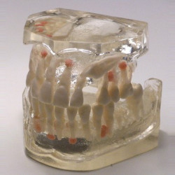 Dental Typodont Jaw / Model for Surgery Practice & Model for Surgery