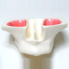 Sinus Lift model - White Resin & Model of jaw in white resin for sinus lifting
