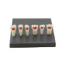 Paediatric Mixed Dentition Typodont Practice Jaw set & Pulpectomy practice teeth (set of 6 teeth)