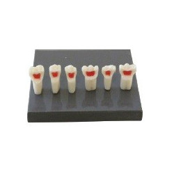 Paediatric Mixed Dentition Typodont Practice Jaw set & Jaw