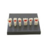 Paediatric Mixed Dentition Typodont Practice Jaw set & Jaw