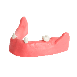 Maxilla with Soft Gums for Implant Training & Mandible with gums
