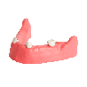 Mandible & Maxilla with Soft Gums for Implant Training & U+L Models with gums