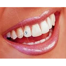 Dental Jewellery - White