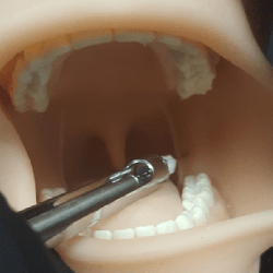 Oral Anaesthesia Training Manikin, Anesthesia