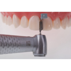 Directa FenderWedge Prep Dental Wedge & 36 pcs pack