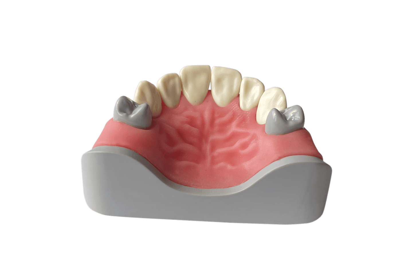 Anterior Dentition Model for Direct and Indirect Restorations (Upper)