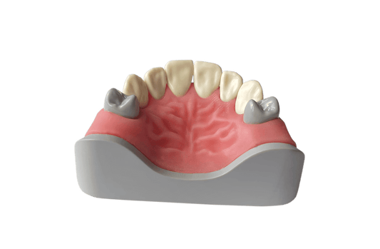 Anterior Dentition Model for Direct and Indirect Restorations (Upper)