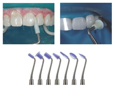 Composite Modeling Instrument iCompoSculpt