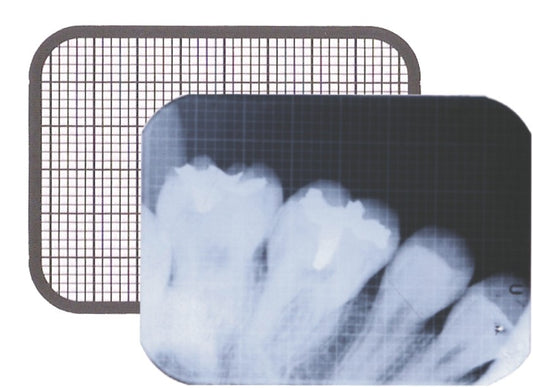 Dental X-Ray Grid IOPA