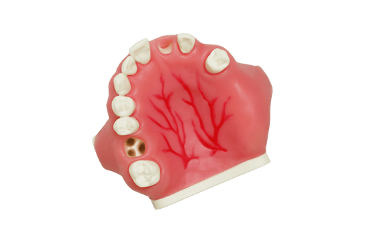 Model for Implant Placement with Sinus Septa