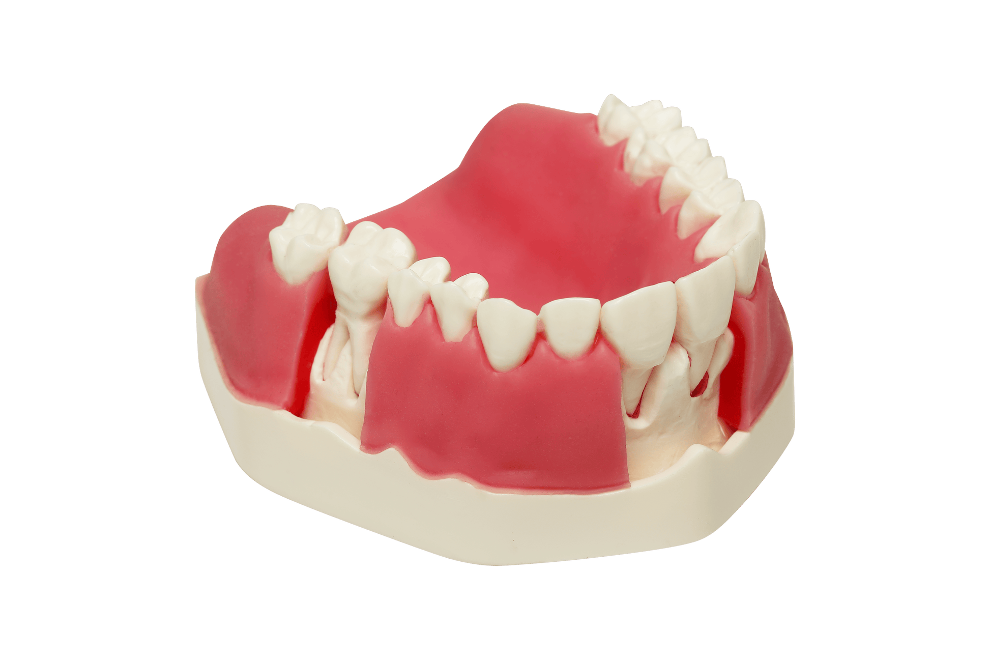 Model with Double Layered Gingiva, Sinus Lift with Schneiderian Membrane