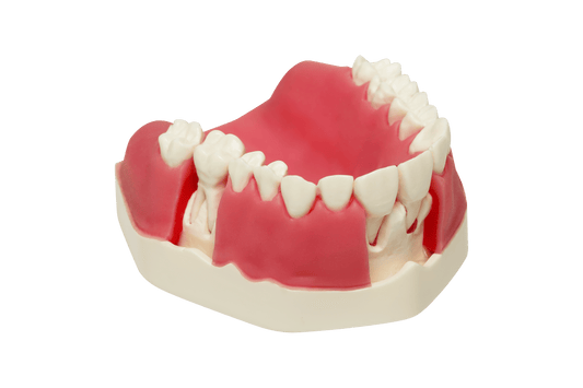 Model with Double Layered Gingiva, Sinus Lift with Schneiderian Membrane