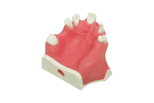Model for Immediate Implant Placement