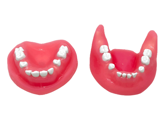 Impacted Tooth Extraction Surgery Dental Jaw Model