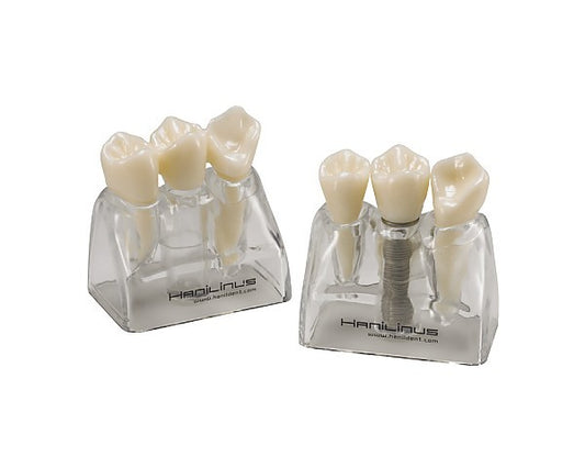 Implant Tooth Model 3000