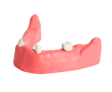 Mandible & Maxilla with Soft Gums for Implant Training
