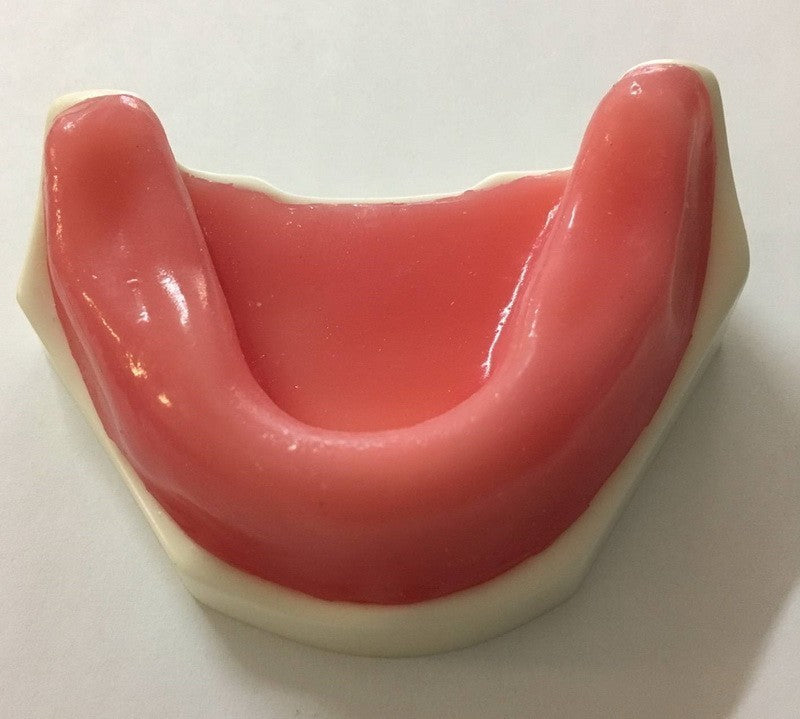 Spongy Bone Implant Mandible with Gums