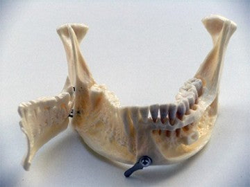 Dental Anatomical Mandible with Extractable Teeth