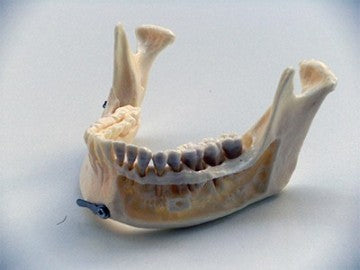 Dental Anatomical Mandible with Extractable Teeth