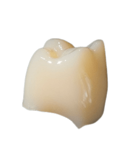 Navadha 3D Printing Resin for Temporary Restoration 1000ml