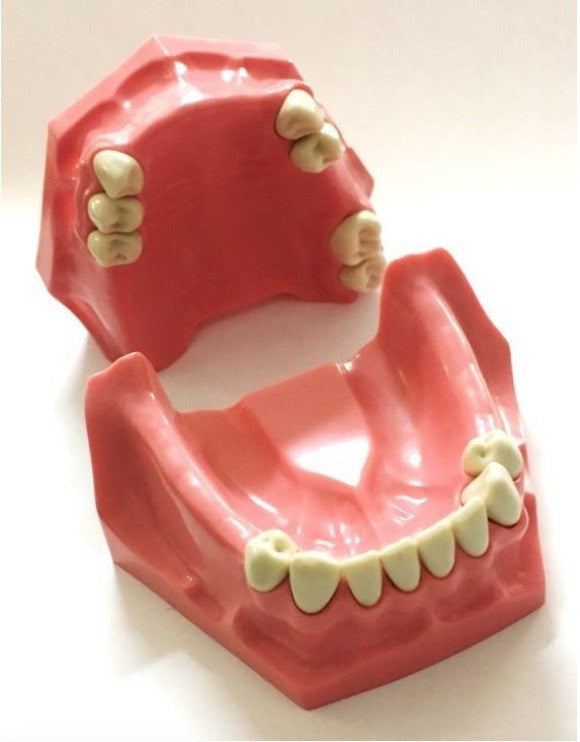 Partial Model for Prosthesis